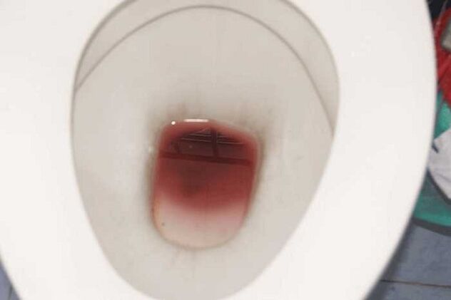 spotting in men when they are excited